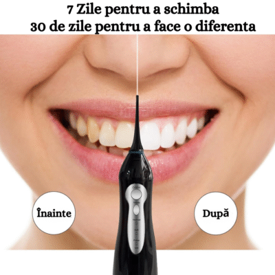 Irigator Bucal Profesional BIRAI® L15 Smart – Portabil, Fără Fir, 5 Programe, 1800 Pulsatii/min, IPX7, Rotire 360°, 4 Capete, Rezervor 300ml, Baterie 2000mAh, Negru - imagine 2