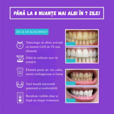 Kit Albire Dinți GlorySmile – 3x Gel fără Peroxid, Lumină LED Roșu+Albastru, Mulaje Incluse, USB & Reîncărcabil - imagine 4