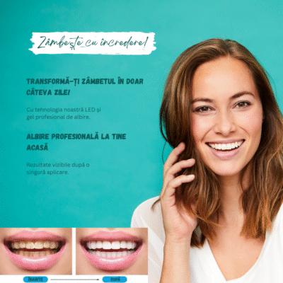 Kit Albire Dinți GlorySmile – 3x Gel fără Peroxid, Lumină LED Roșu+Albastru, Mulaje Incluse, USB & Reîncărcabil - imagine 2